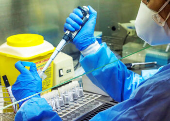 Još 73 osobe pozitivne na virus Covid-19