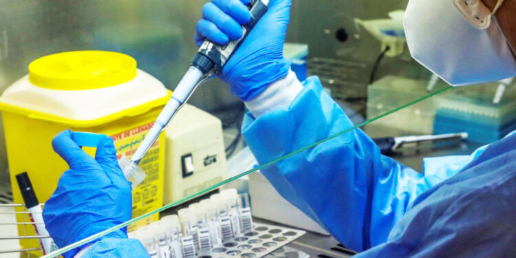 Još 73 osobe pozitivne na virus Covid-19