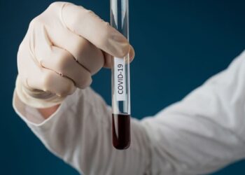 COVID-19: Stigli rezultati sa jučerašnjih testiranja u Južnom Banatu