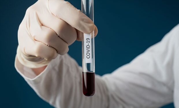 COVID-19: Stigli rezultati sa jučerašnjih testiranja u Južnom Banatu